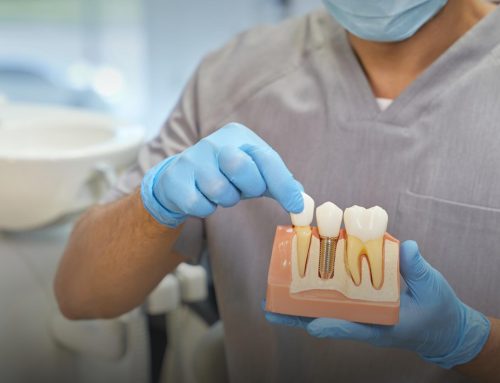 Dental Implants: Why They’re Worth The Investment